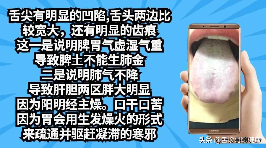舌诊哥聊健康调脾胃,舌诊哥聊健康