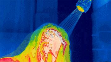 头皮屑太多的简单处理办法,头皮屑多怎么办最有效的方法