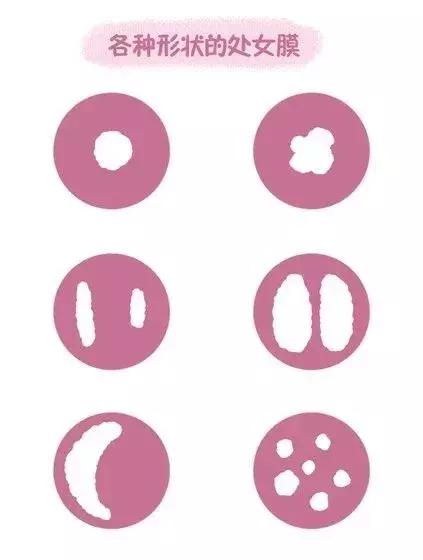 网友说“第一次”没流血是咋回事？为啥又那么痛？真相值得了解