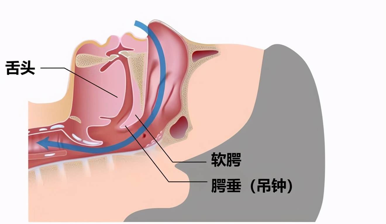 打鼾过程,打鼾呼吸机原理
