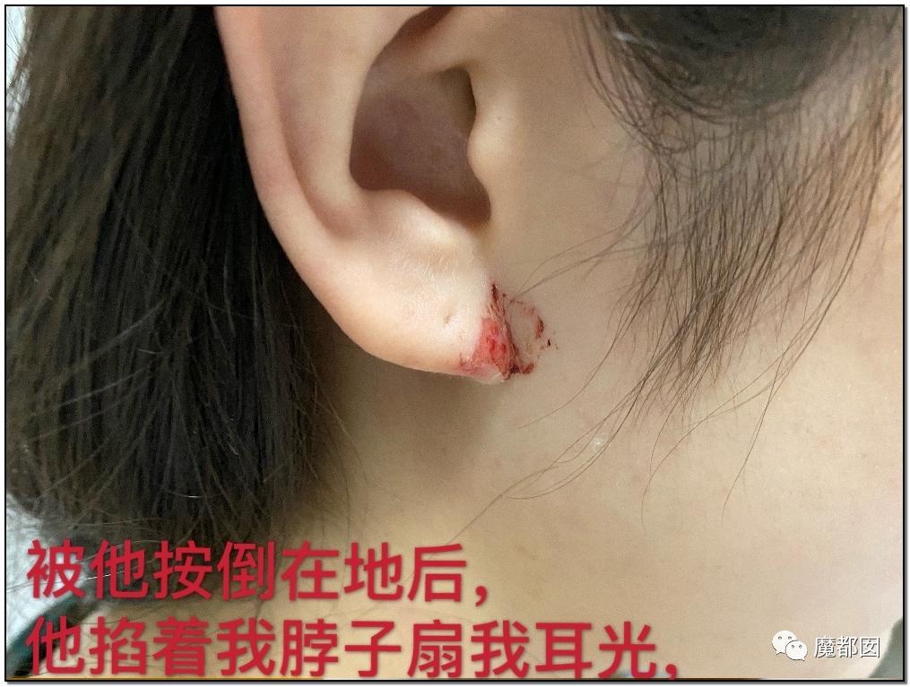 短跑名将张培萌家暴事件,短跑名将张培萌殴打岳母视频