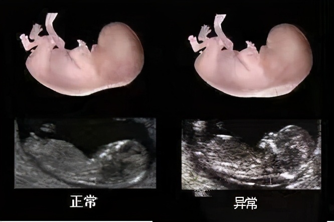 关于孕期产检几个大家关心的问题