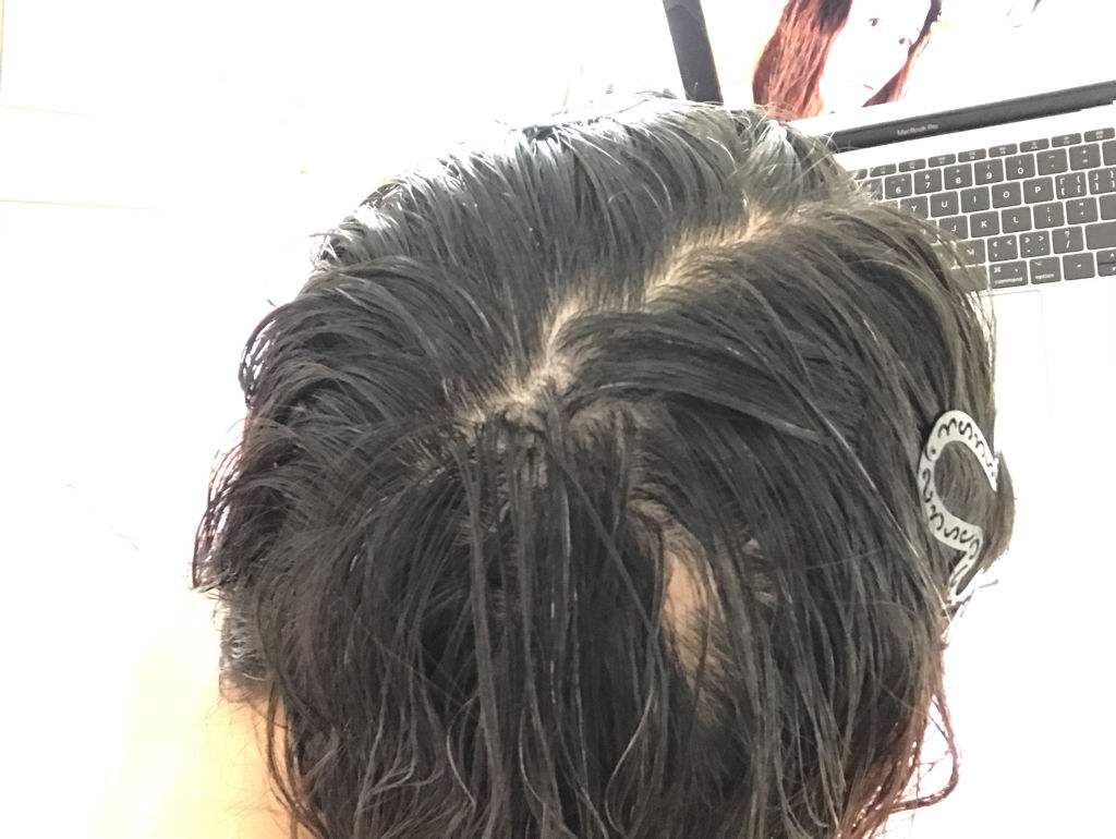 中医认为身体湿气重，易致慢性病！四个征兆判断是否湿气过重