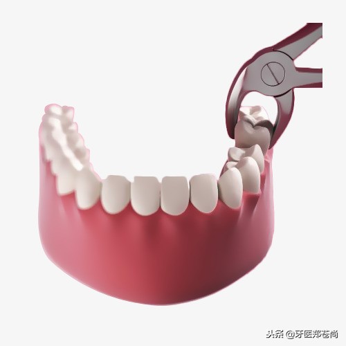 拔完智齿拆线后多久可以正常吃饭,拔完智齿后能不能吃饭