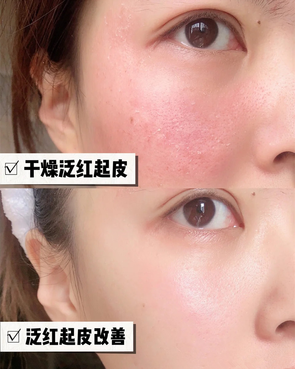 李佳琦伸手“护肤界”，安利这四款面霜平价又好用，太懂女人的心