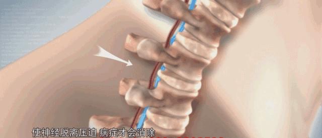 躺着就能治疗颈椎不适？广州这个“高科技”太惊奇了