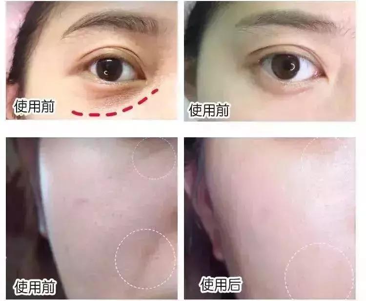 明星童颜秘诀，每1秒卖出10瓶的TA，素人高呼有效淡纹、去暗沉！