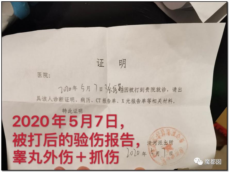 短跑名将张培萌家暴事件,短跑名将张培萌被控家暴