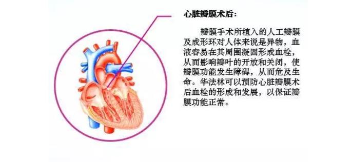 华法林长时间服用的副作用有哪些,华法林和小苏打能一起服用吗