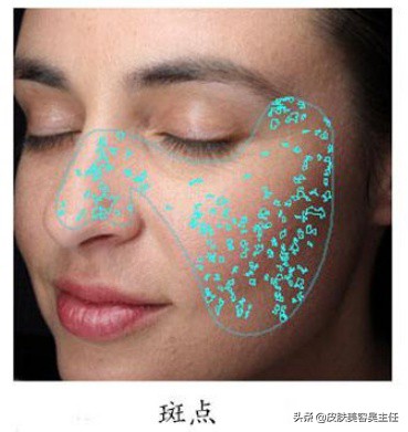 visia皮肤检测分高低吗,visia皮肤检测值多少是正常的