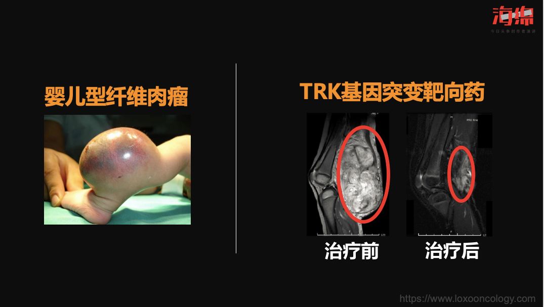 李治中癌症真相全集,李治中癌症科普可靠吗