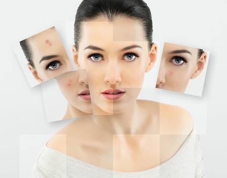 鼻子上痘印消不掉怎么办,青春期痘痘密集痘印消不掉怎么办