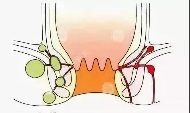肛门潮湿是怎么回事吃啥中成药,肛门潮湿是怎么回事啊