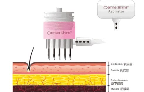 快速美白的有效简单方法,美白有效方法医生建议