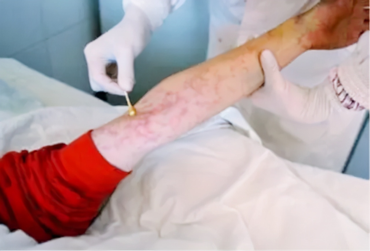 艾滋病毒来源于猩猩,第一个感染的人类是如何染上的?