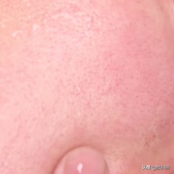 御泥坊九法净颜泥浆面膜使用方法,御泥坊氨基酸泥浆面膜会不会过敏