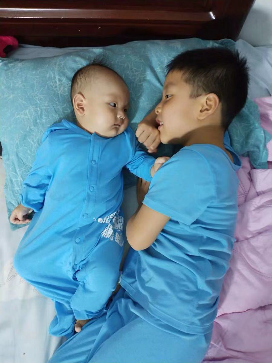 小儿湿疹会不会一直出汗,2个月的小儿湿疹反反复复