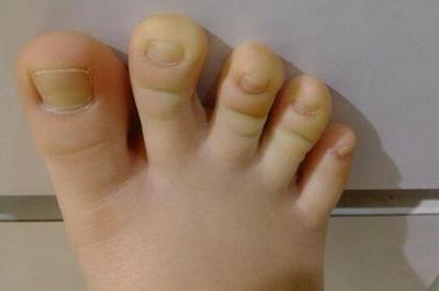 二拇脚趾长的人是不孝顺娘吗,脚拇指长的是孝顺还是不孝顺