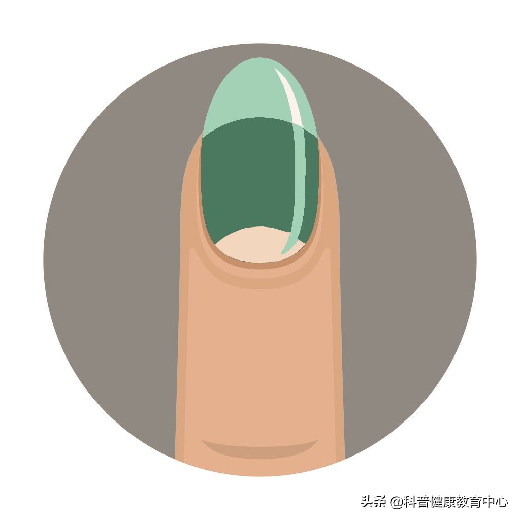 手相的科学解释,从医学角度解读手相的秘密