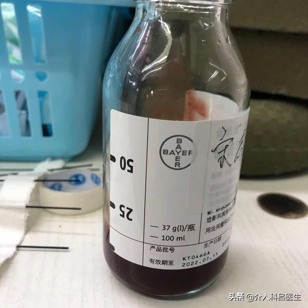 子宫腺肌症+巧囊很棘手？医生一根针，改变子宫内部环境