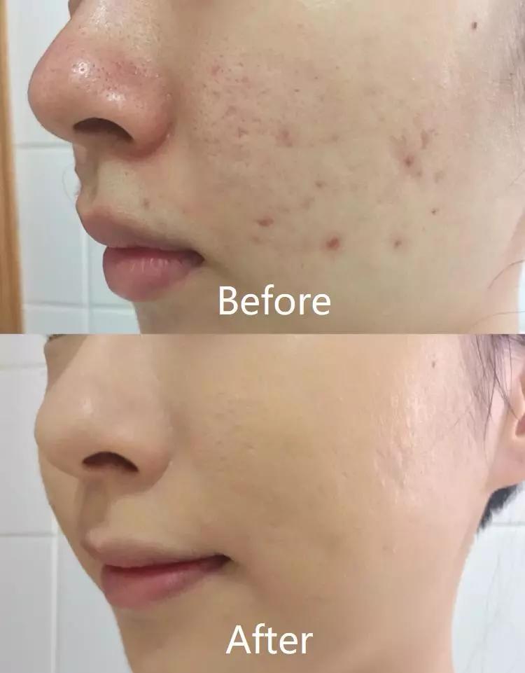 毛戈平的气垫好还是粉霜好,毛戈平的气垫哪种好用