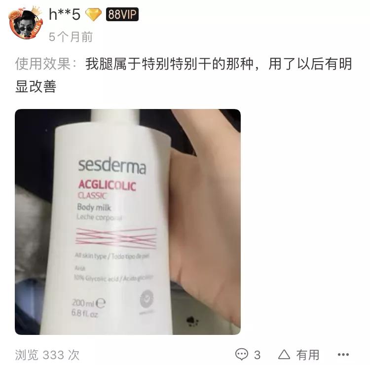 吴昕的小腿变化,吴昕的腿到底怎么瘦的