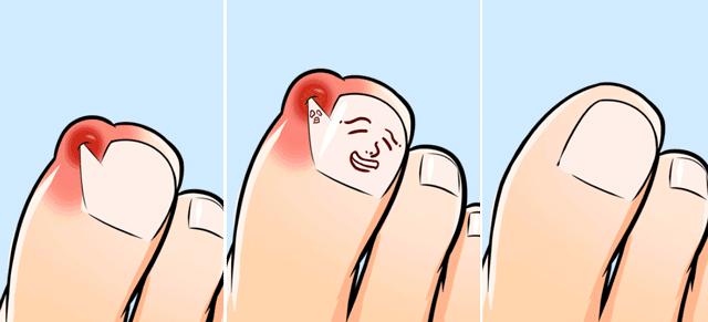 女人美甲到底该不该做,美甲指甲表面开裂是怎么回事