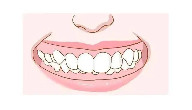 木偶纹下垂怎么提升,20岁木偶纹怎么消除