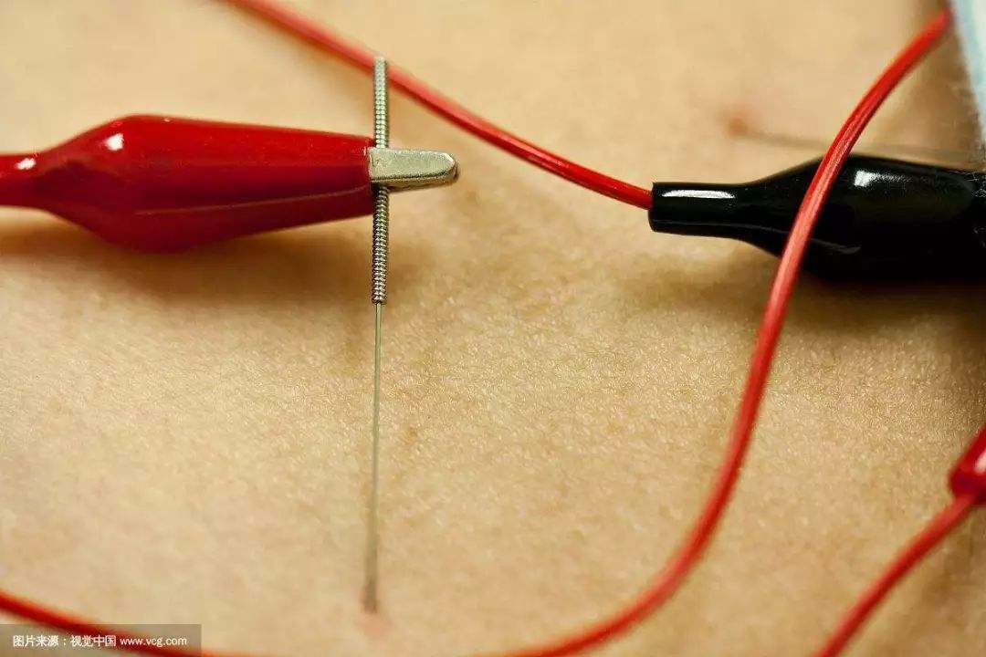 颈椎病的最快最有效的锻炼方法,7个有效的颈椎病的自我治疗方法