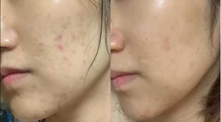 海蓝之谜水和神仙水哪个好用,海蓝之谜护肤水乳美白补水