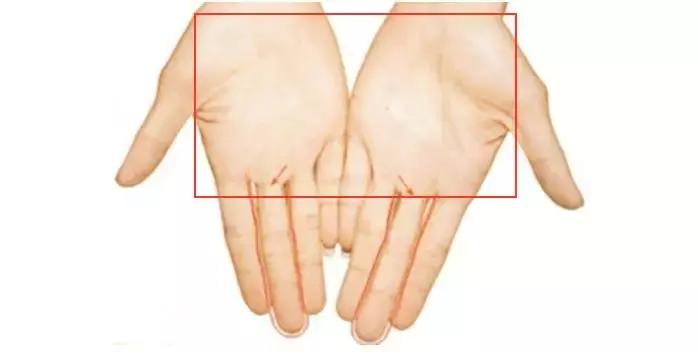 眼睛干涩视物模糊有血丝,眼睛干涩视物模糊感觉有层雾