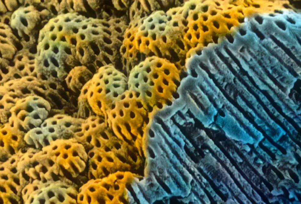 上海雅悦齿科,雅悦齿科种植牙