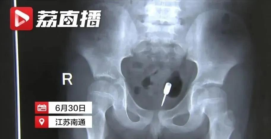 熊孩子用弹弓射人被垃圾车送走,9岁男孩把飞镖塞下来