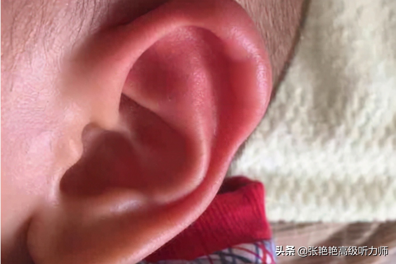 耳朵发热是不是有人背后说我坏话,耳朵发热是有人背后说坏话吗