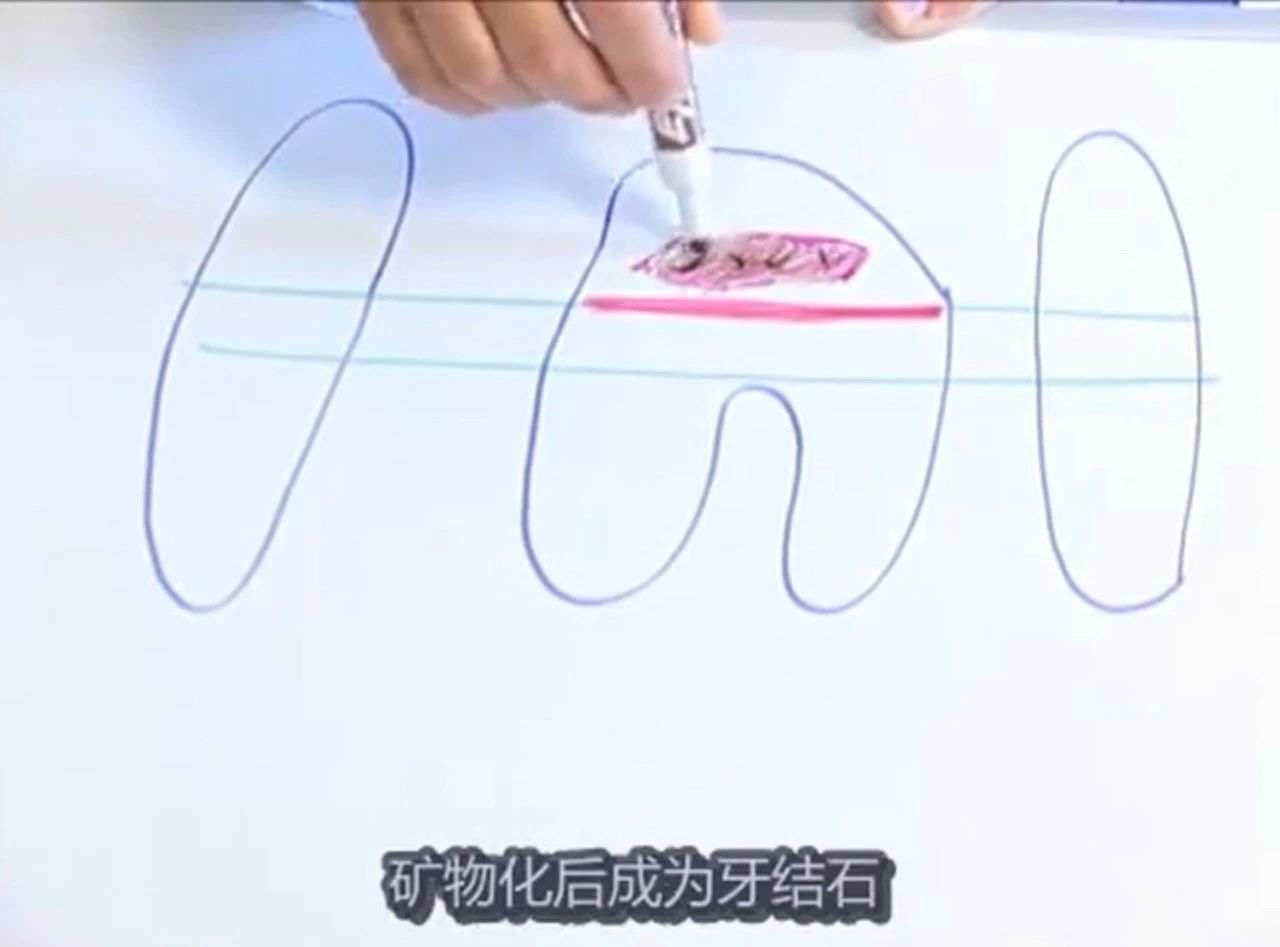 你的猫是否也有一个糟糕的口腔环境？谈谈猫口腔疾病那些事儿