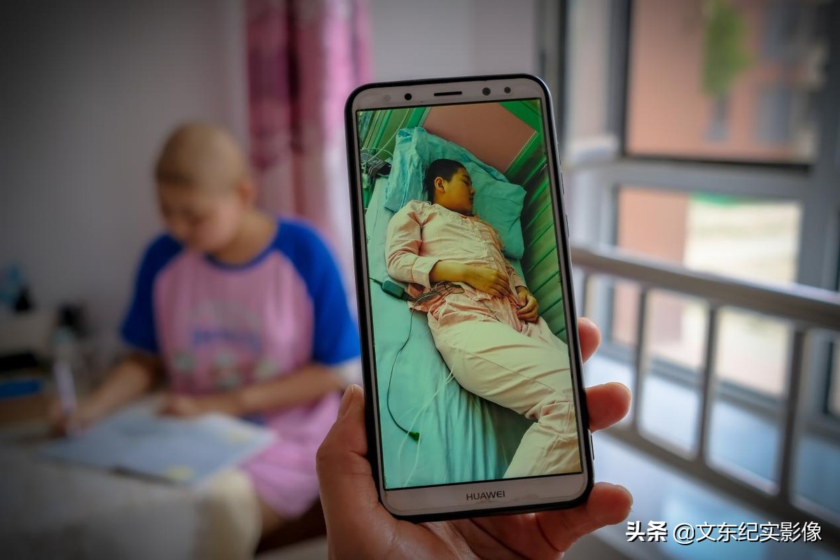 大头娃娃目前能治好吗,大头娃娃患病的原因是