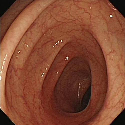 便秘不是小事,便秘不是大问题不需要太过紧张