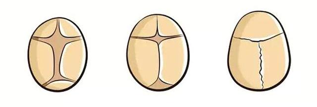 补充ad和dha导致囟门闭合过早,新生儿囟门大可以ad和d3一起补吗