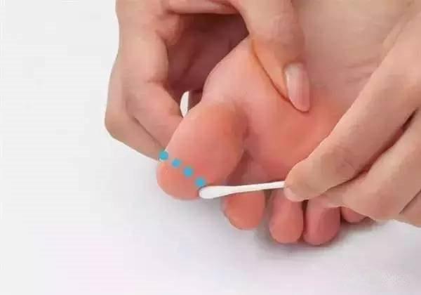 一个小妙招全身的痛都能治,一根棉签的效果视频