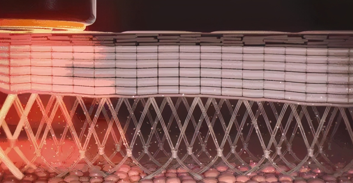 comper美容仪是智商税吗,美容仪哪一个最好用不是智商税