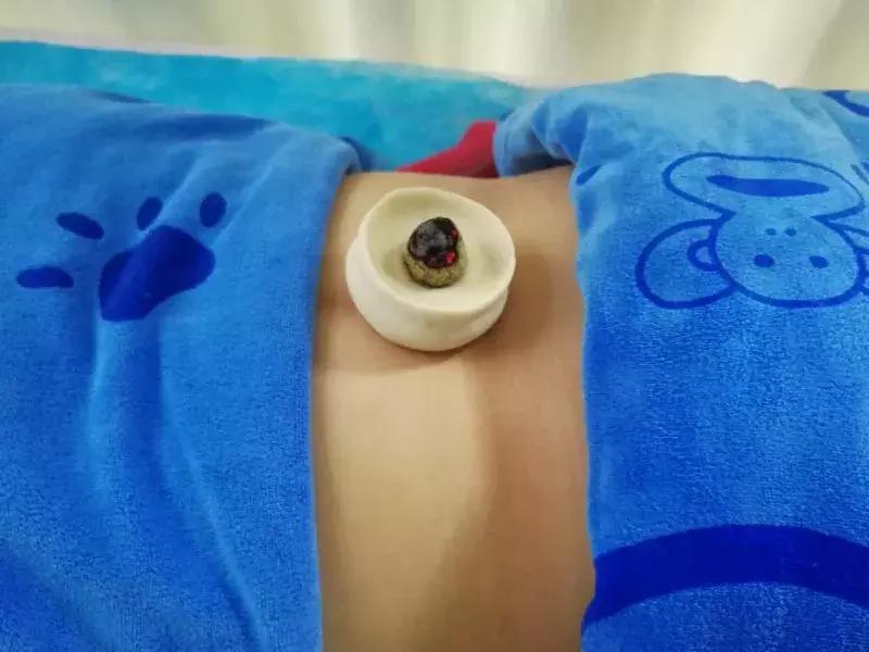 我院冬病夏治火热预约,五院门诊预约电话