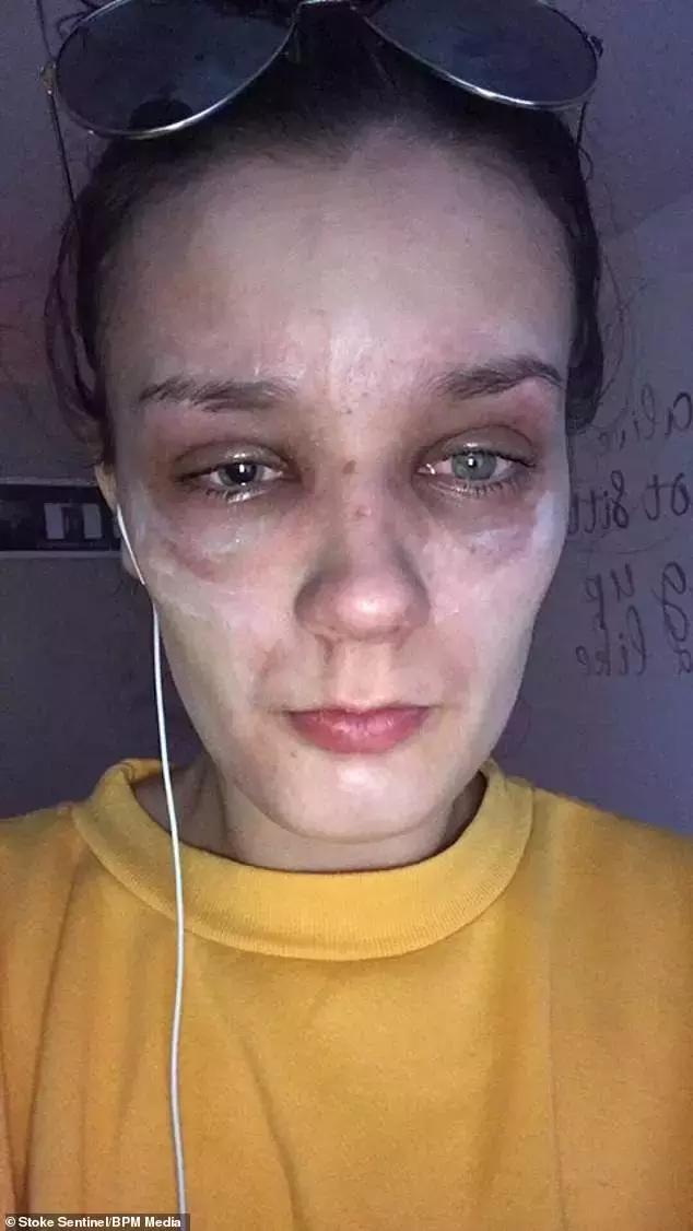 因为一时疏忽让自己悔恨终生,因为一时的疏忽造成了终身后悔