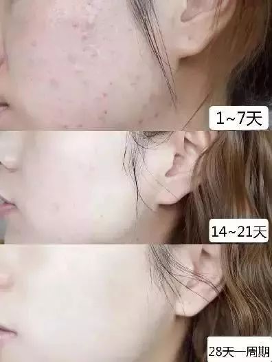 李佳琦推荐氨基酸洗面奶无皂基,李佳琦会拉丝的洁面皂