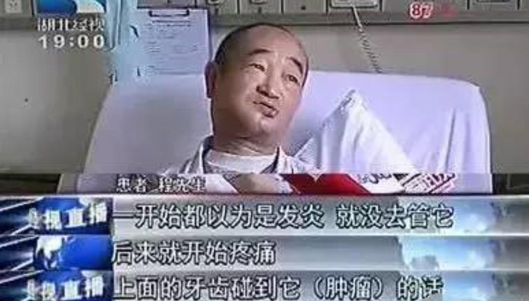 蛀牙未坏有没有补救方法,蛀牙不敢治疗怎么办