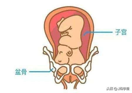 27岁孕妇，怀孕34周发生这些症状，去医院检查，才知道原来这样
