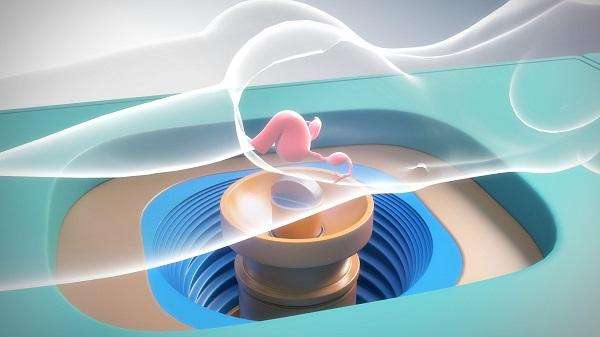 痛经10年，止痛药失灵！刚45岁就子宫不保？海扶刀带来希望