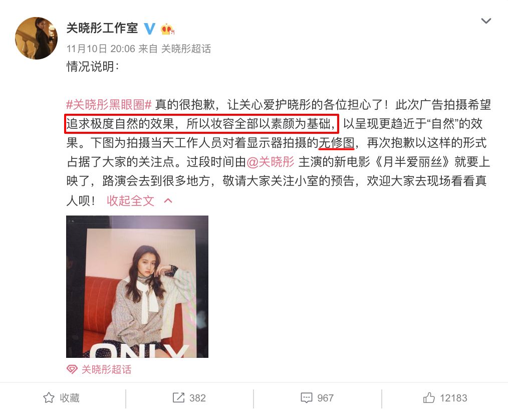 关晓彤有没有黑眼圈,关晓彤黑眼圈困扰