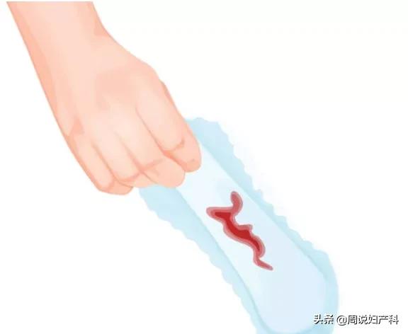 经血多会导致子宫腺肌症,经量增多经期延长见于哪些病