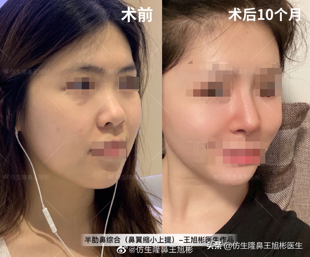 被鼻子封印的颜值,那些被鼻子封印的颜值