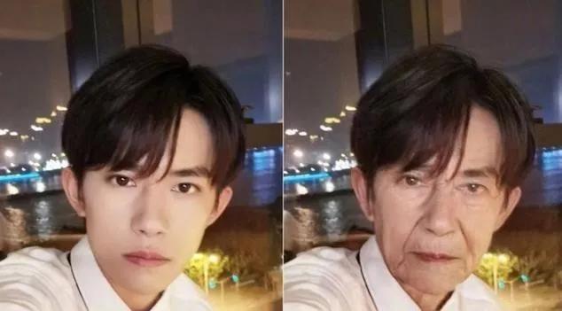 硬刚女皇龙妈也扛不住法令纹,2条沟壑让人心疼,贴一贴就消了